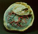 Vorschau Placenta mit injizierten Venen und Arterien, menschlich