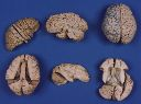 Vorschau Serie plastinierter Gehirne, menschlich