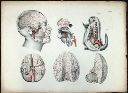 Vorschau Anatomischer Atlas von M. D. Weber, TAB. XXX