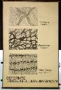 Vorschau Wandtafel, Geformte Interzellularsubstanzen