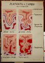 Vorschau Wandtafel, Placenta-Typen, histologisch