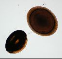 Vorschau Mikropräparat, Statoblasten, Plumatella repens (Tentaculata)