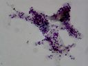 Vorschau Mikropräparat, Amoeba proteus