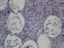 Vorschau Mikropräparat, Monocystis lumbrici