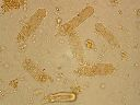 Vorschau Mikropräparat, Clepsidrina polymorpha