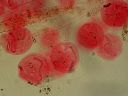 Vorschau Mikropräparat, Vorticella nebulifera