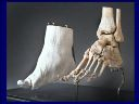 Vorschau Fuß einer Chinesin, präparierte Knochen und Gipsabguss