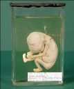 Vorschau Menschlicher Fetus, Alkoholpräparat